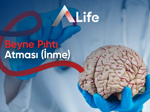 Beyne Pıhtı Atması